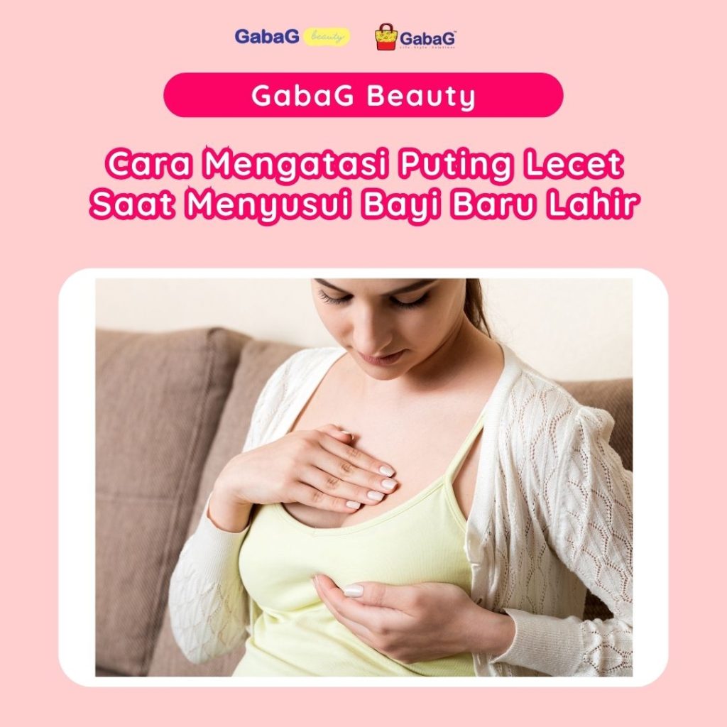 Cara Mengatasi Puting Lecet Saat Menyusui Panduan Lengkap Untuk Ibu Menyusui