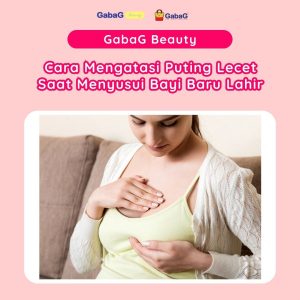 Cara Mengatasi Puting Lecet Saat Menyusui Panduan Lengkap Untuk Ibu Menyusui