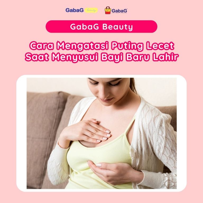 Cara Mengatasi Puting Lecet Saat Menyusui Panduan Lengkap Untuk Ibu Menyusui